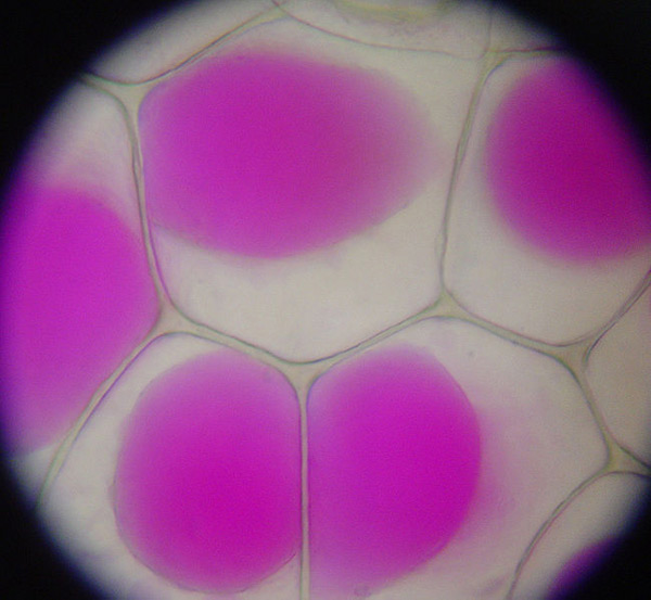 Rhoeo_Discolor_Plasmolysis.jpg